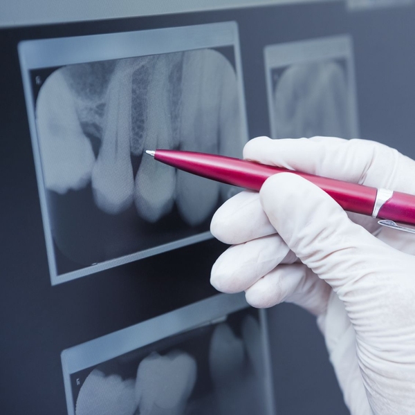 dental x-ray