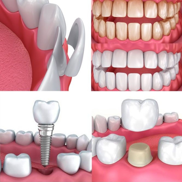 cosmetic dentistry procedures
