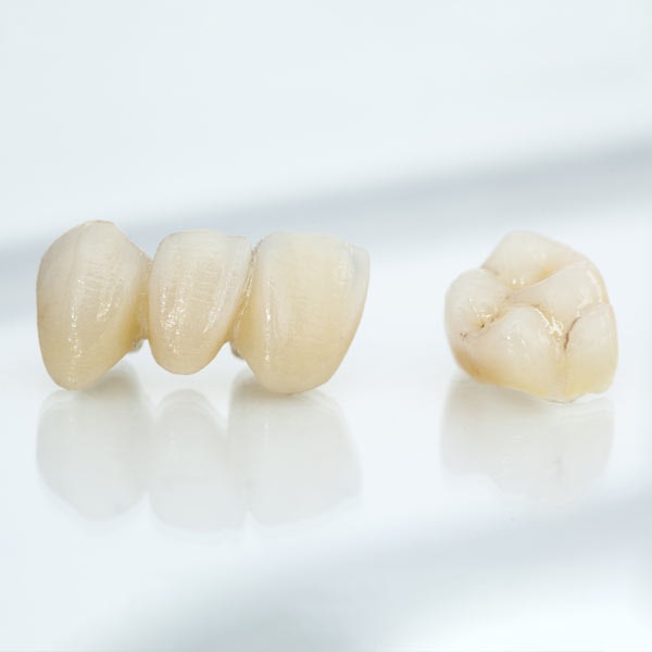 Dental bridge and crown