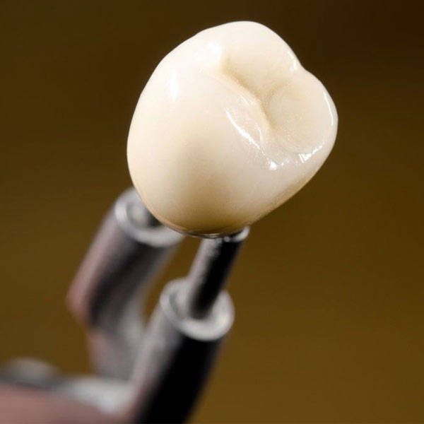dental crown