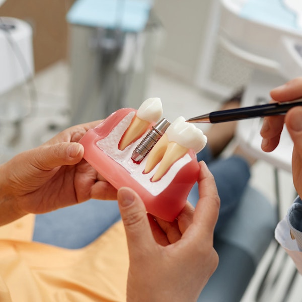 Dentist using model of jaw and implant to educate patient